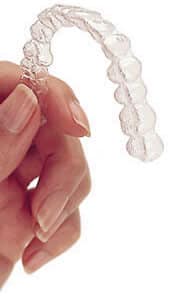 Invisalign Orlando Florida | Mosaic Dental Center - Mosaic Dental Center Invisalign orlando florida