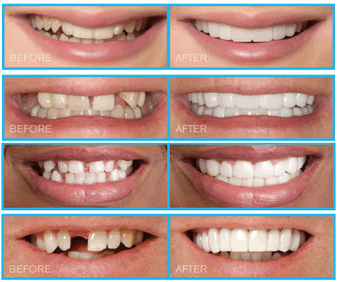 Mosaic Dental Center Orlando Florida