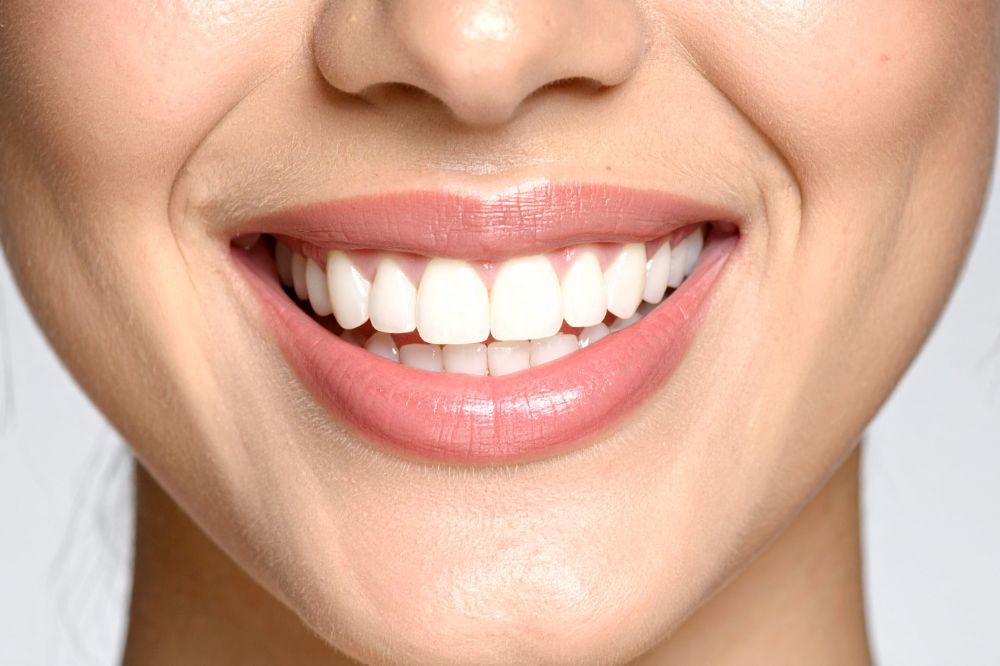 - Mosaic Dental Center Teeth whitening safe options for a brighter confident smile